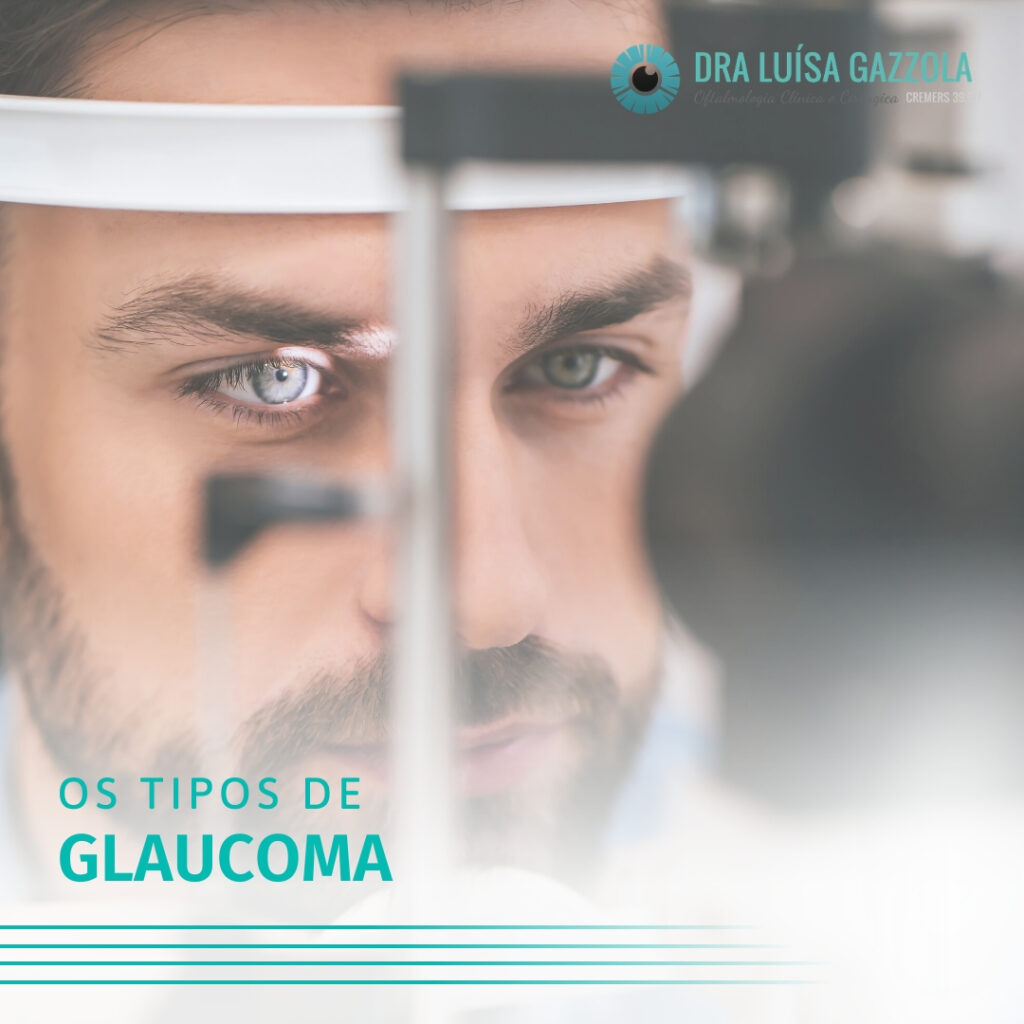 os tipos de glaucoma