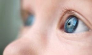 Catarata congenita clínica de oftalmologia em Passo Fundo